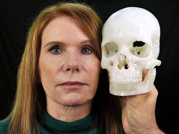 Atajo para cirugía del cerebro: hacerlo a través del párpado