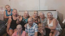 Mónica tiene cáncer y se rapó la cabeza... pero no fue la única