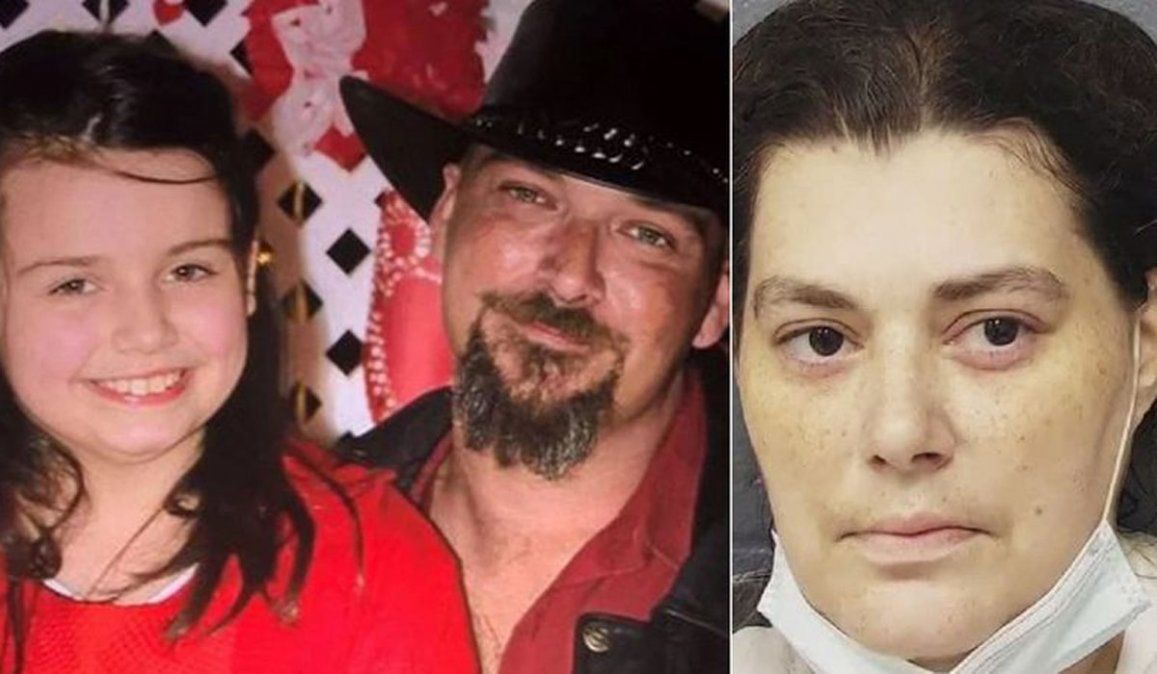 Padres dejaron que los piojos coman a su hija de 12 años y están acusados de asesinato