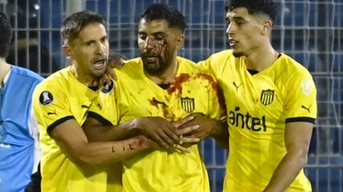 Maximiliano Olivera es acompañado por sus compañeros de Peñarol tras sufrir una agresión al finalizar el partido que disputaron contra Rosario Central.