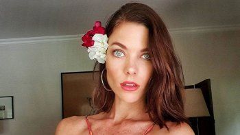 Laura Laprida contó que tiene cáncer de piel por exponerse al sol sin protección