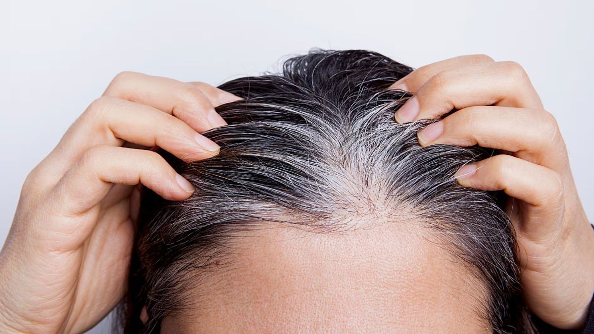 Las canas pueden ser disimuladas con bicarbonato de sodio.&nbsp;