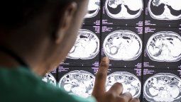 En Argentina se tiene registro de menos del 15% de los casos de cáncer