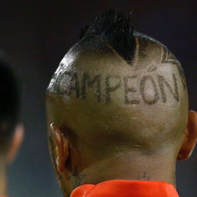 Ah bue... el cortecito de pelo que estrenó Arturo Vidal