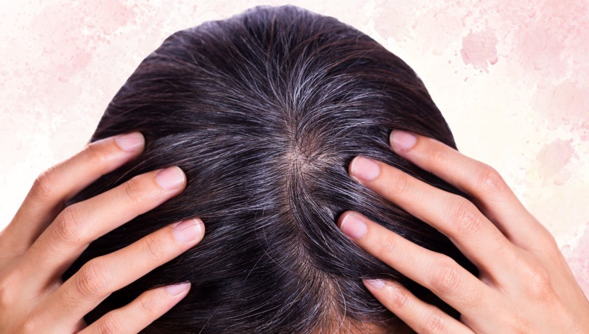 Llegó el fin de las canas gracias a esta combinación de bicarbonato de sodio y shampoo. Llegó el fin de las canas gracias a esta combinación de bicarbonato de sodio y shampoo.