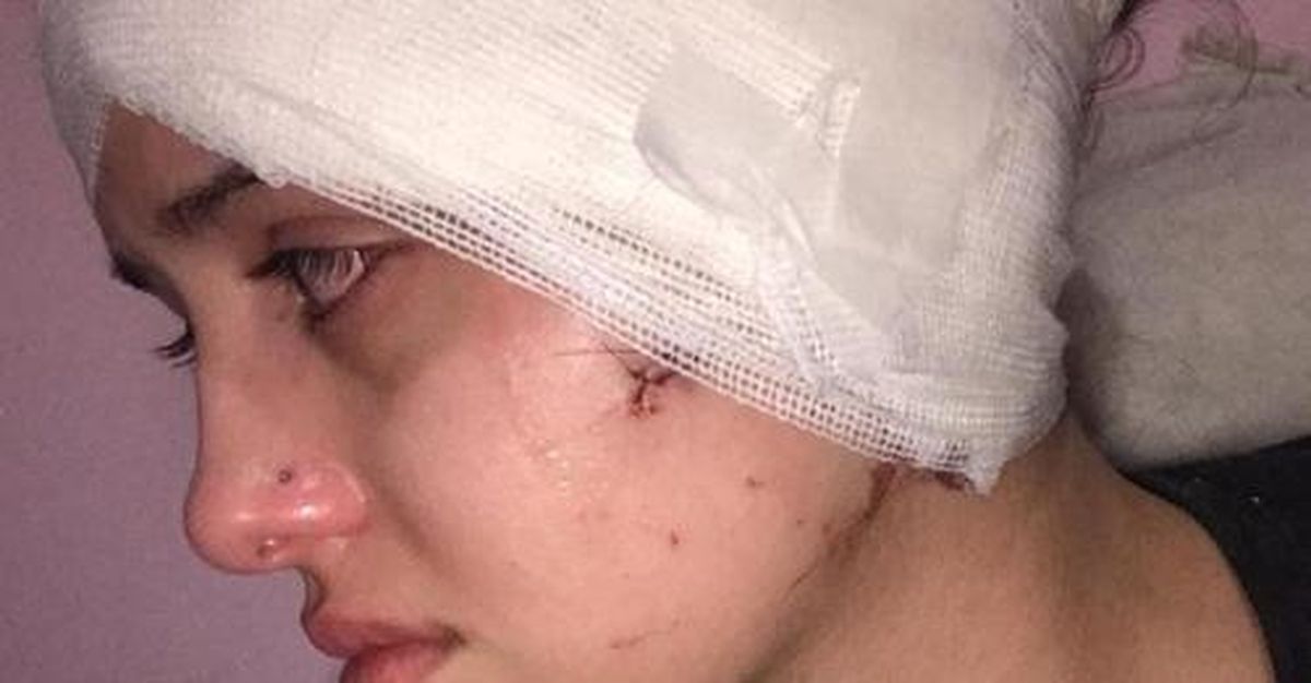 Agustina Tramontana terminó con una cicatriz y distitnas consecuencias del ataque sufrido por José Luis Pericoli.