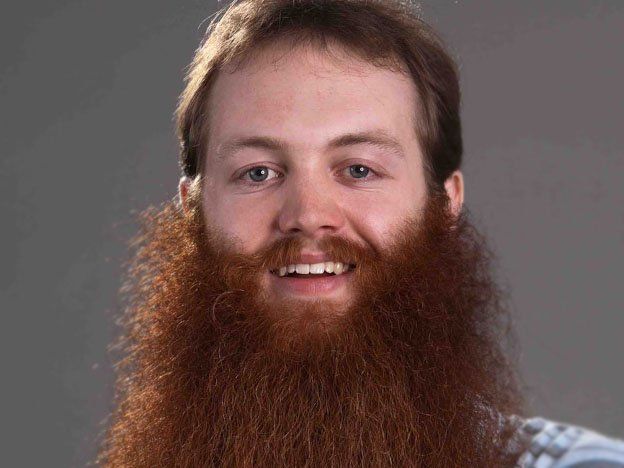El implante de barba hace furor en Nueva York