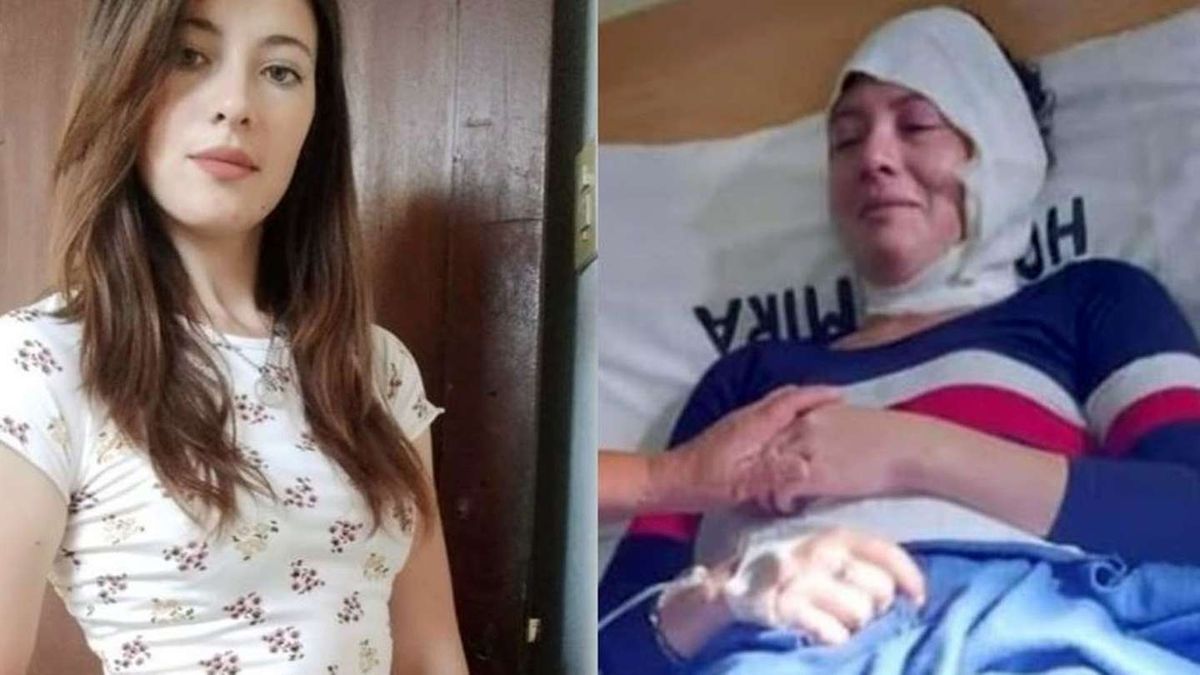 Violencia de género. Quemó a su ex esposa con aceite hirviendo.