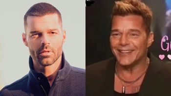 Ricky Martin se retocó la cara y ya hay quienes dicen que parece Mickey Rourke