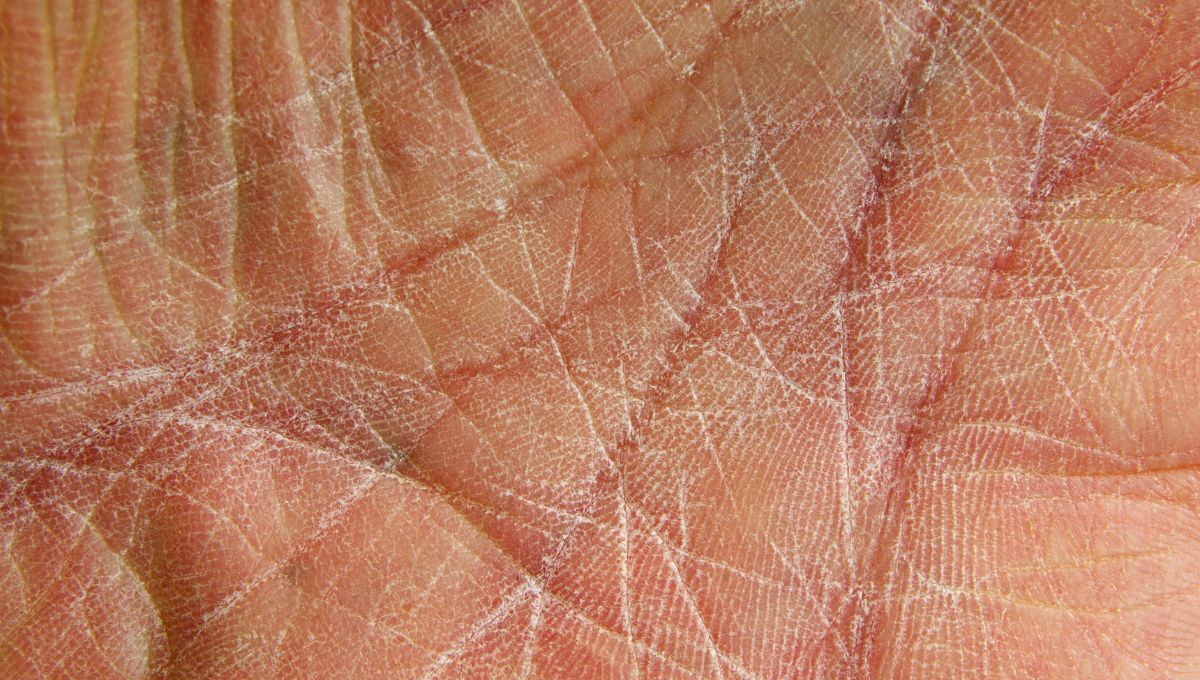 Manos secas. Manos secas.