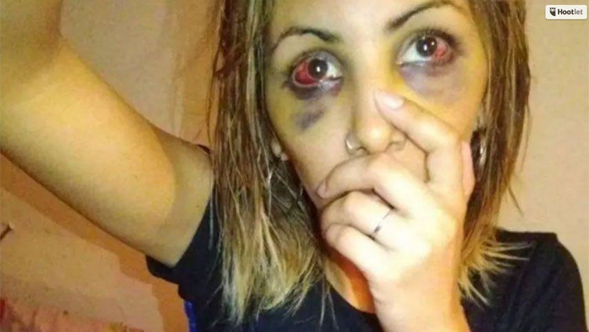 Golpeó salvajemente a su ex novia a pesar de tener la restricción de acercamiento