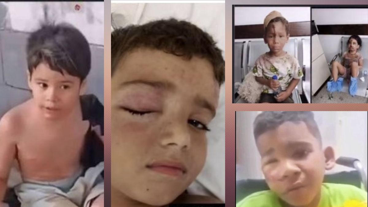 Niños que llegan a los hospitales de Venezuela solos y heridos, una de las situaciones más crudas de las que se viven por estas horas en Venezuela&nbsp;