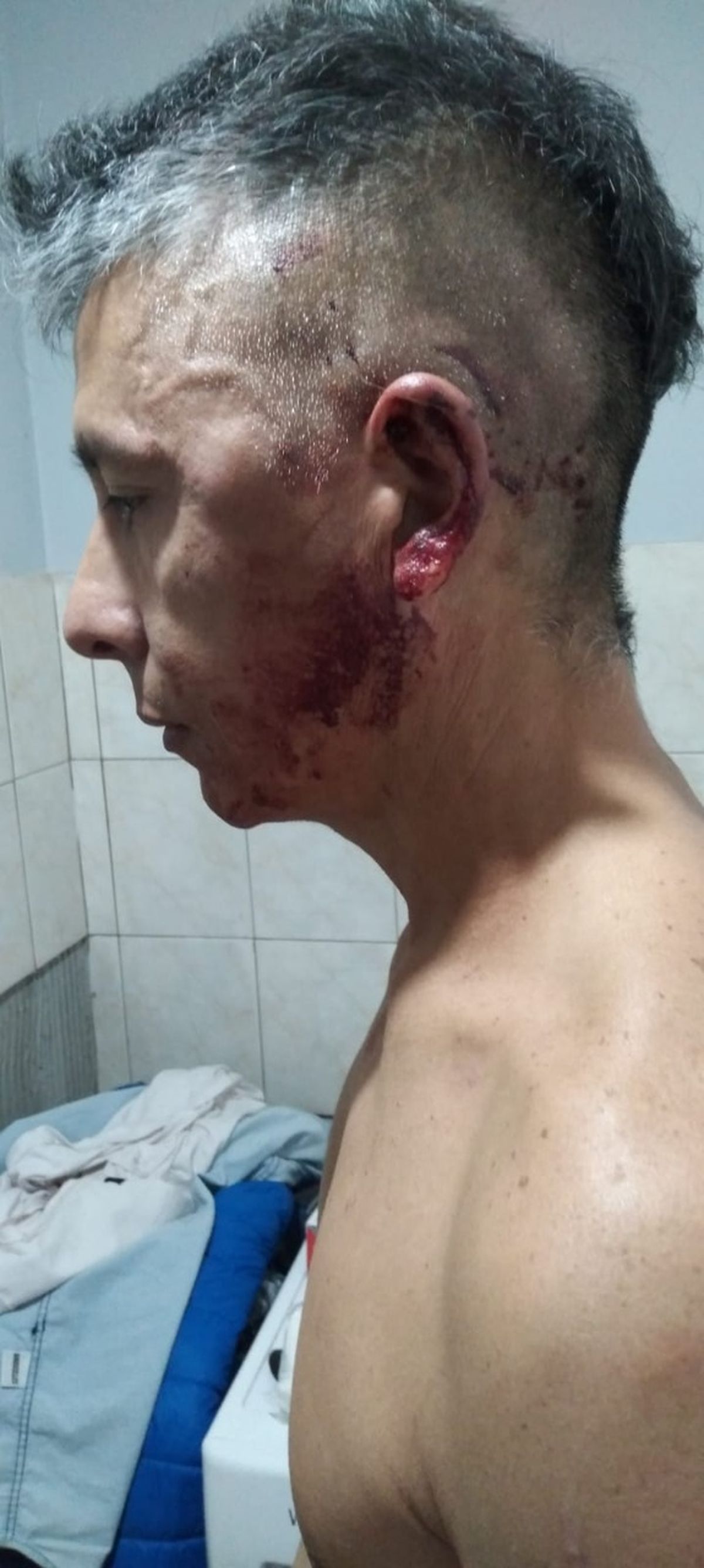 Así quedó el conductor agredido en el Automac de Palmares