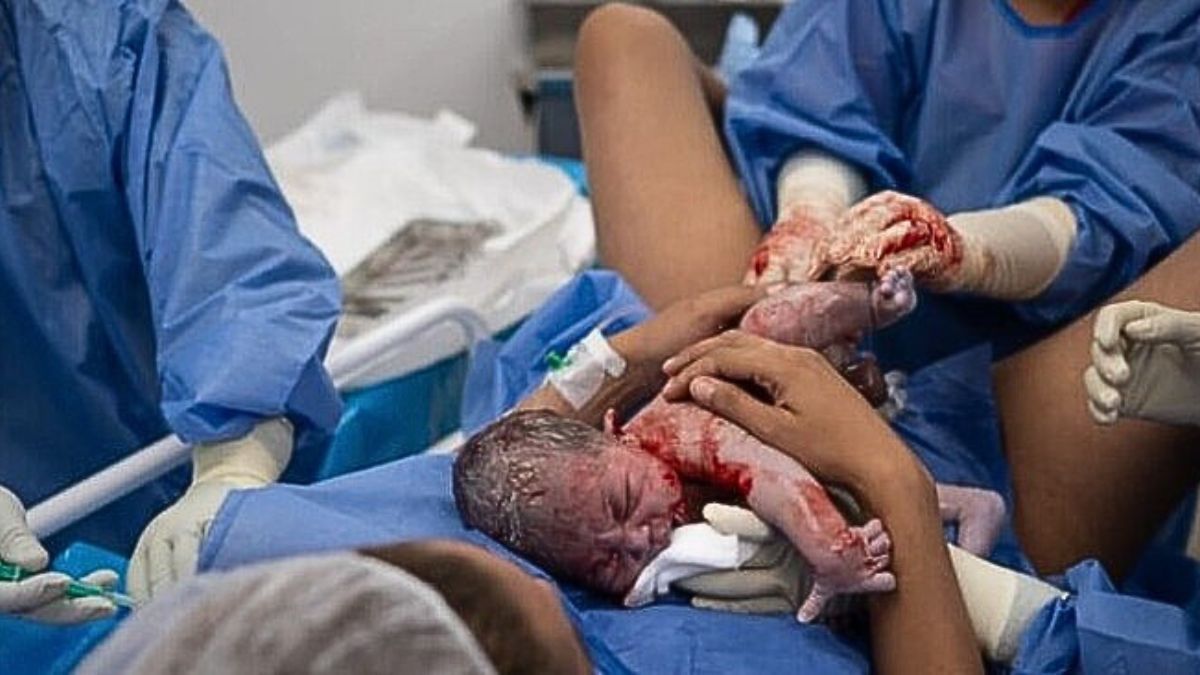 El contacto El contacto