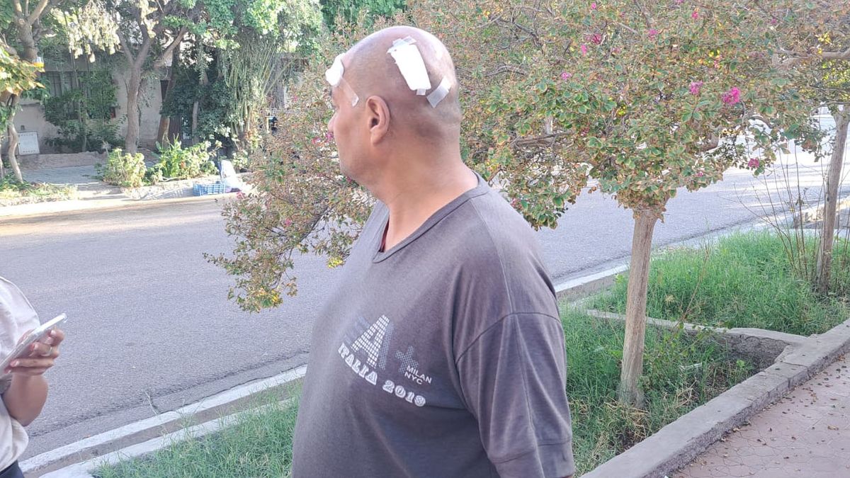 El delincuente le disparó dos veces, pero el taxista logró correrle la mano antes que saliera el disparo. El delincuente le disparó dos veces, pero el taxista logró correrle la mano antes que saliera el disparo.