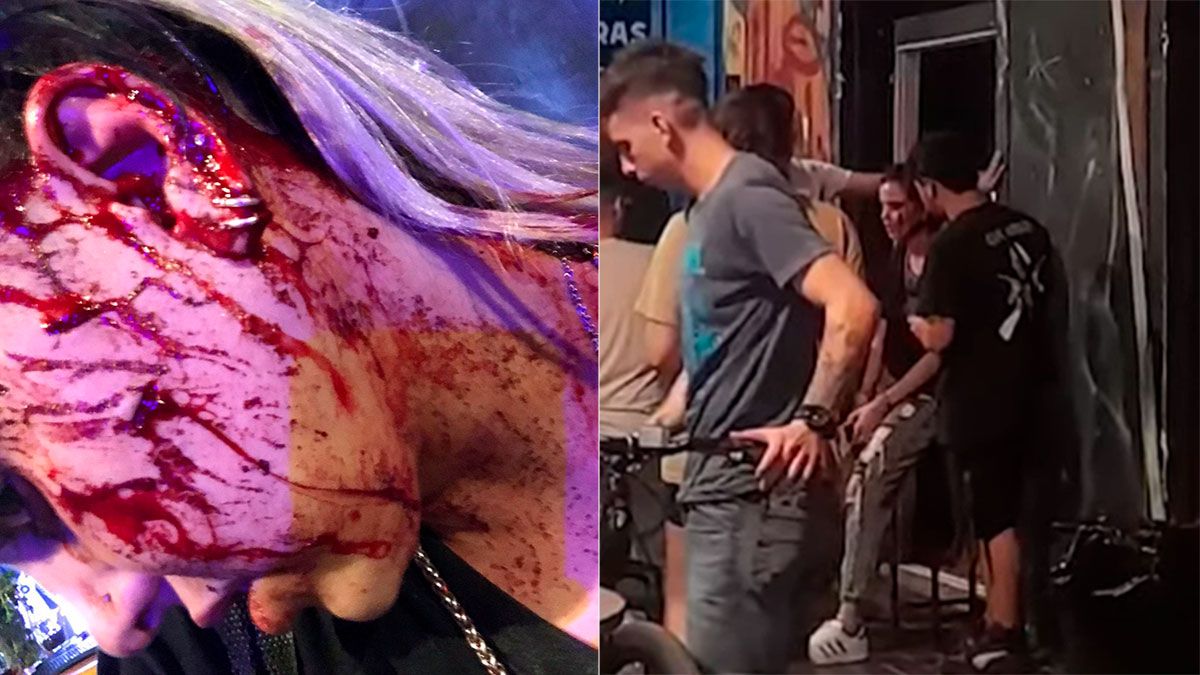 Una moza de un bar de la calle Arístides fue agredida por unos clientes cuando les pidió que abonaran la cuenta.