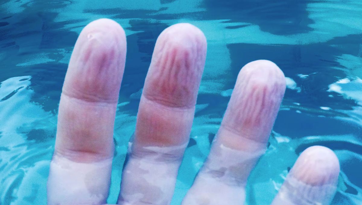 Los dedos arrugados no son peligrosos, pero sí pueden ser un poco molestos. Los dedos arrugados no son peligrosos, pero sí pueden ser un poco molestos. 