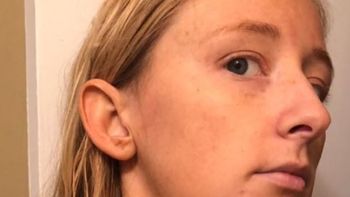 Por un desafío viral de belleza descubrió que tenía cáncer