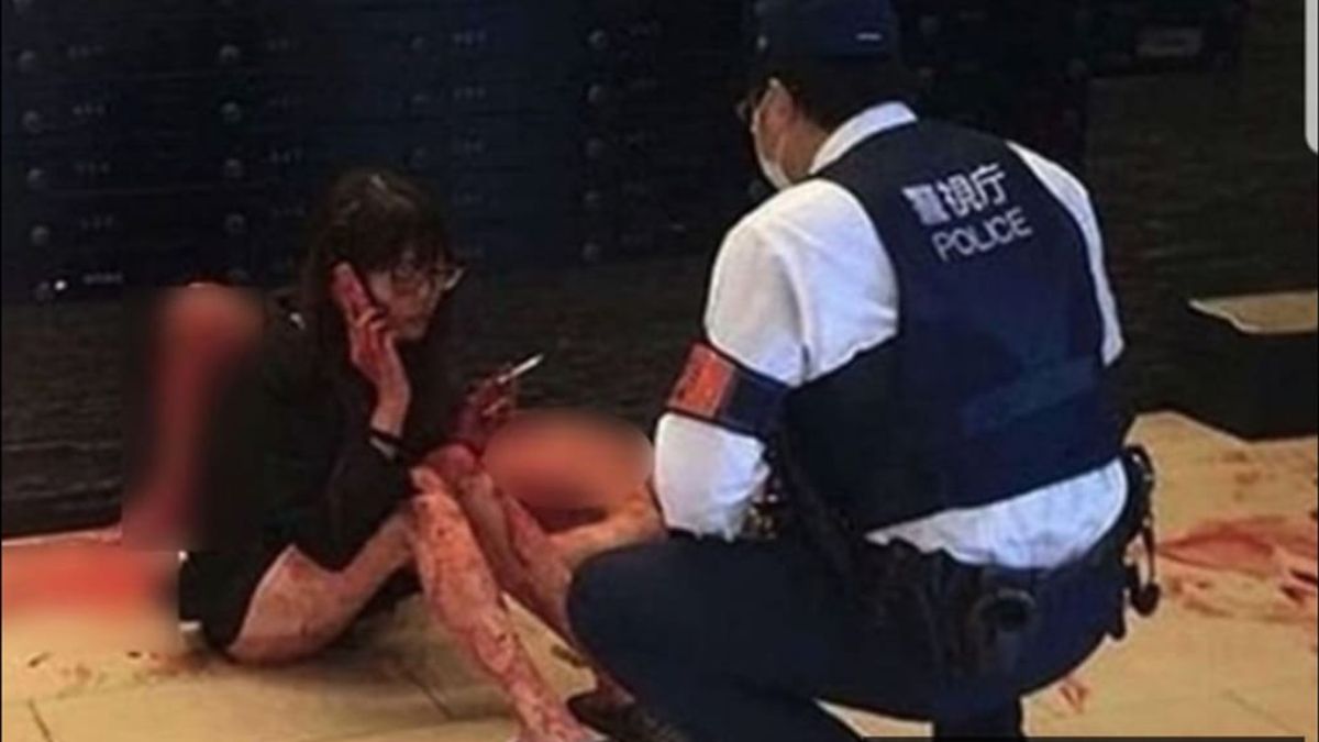 La foto que se viralizó tras el intento de crimen en Japón. La foto que se viralizó tras el intento de crimen en Japón.