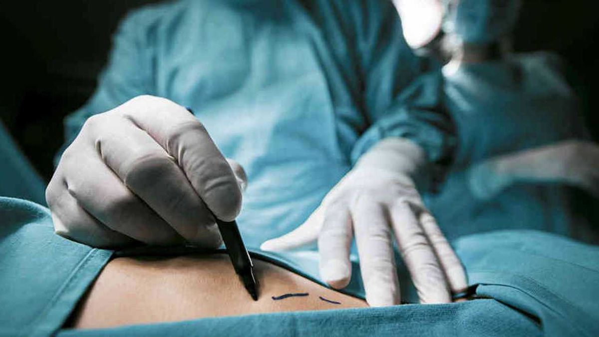 Retiro: odontólogo porteño hacía lipoaspiraciones y cirugías plásticas