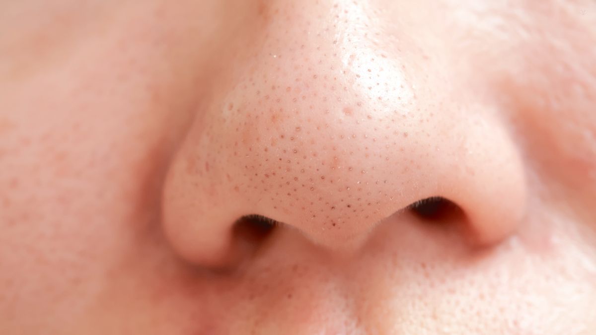 Puntos negros. Puntos negros.