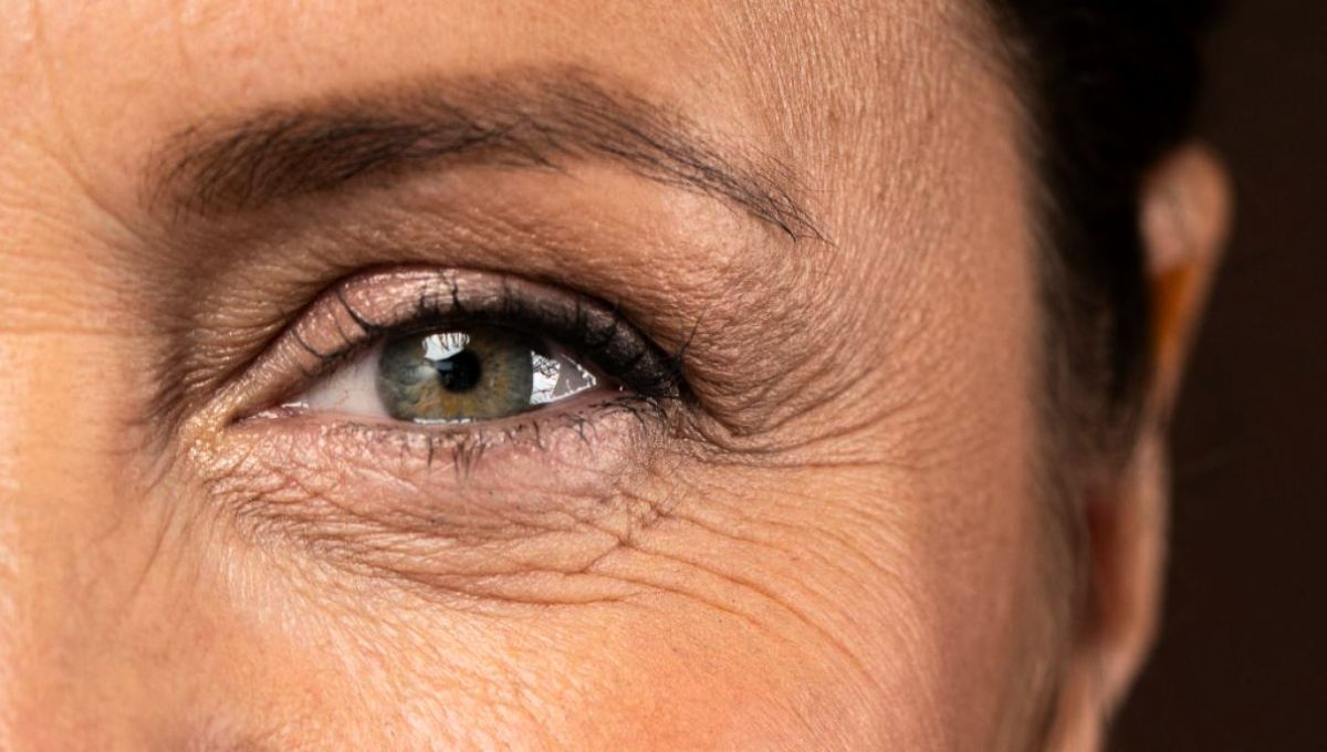 Las arrugas de los ojos suelen ser conocidas como patas de gallo