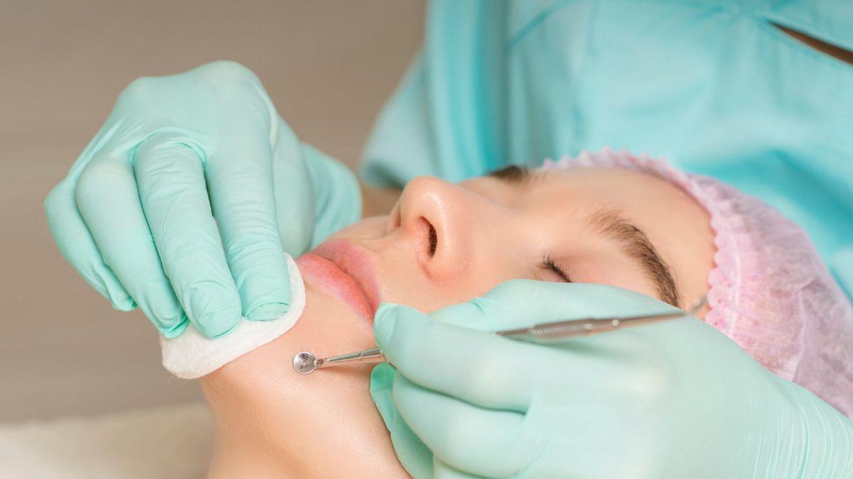 A pesar de que existen tratamientos, la mejor forma de combatir los puntos negros es con remedios caseros.