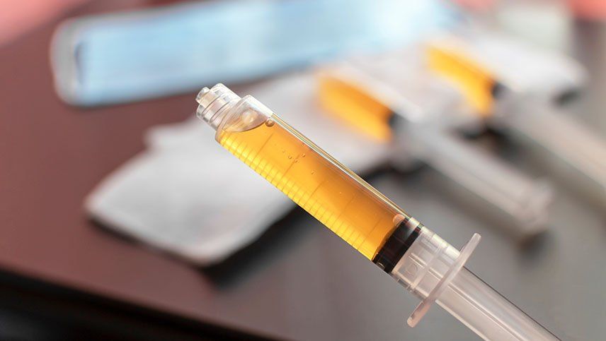 ¿Qué es Plasma Hair?: plasma rico en plaquetas, ahora para recuperar el cabello