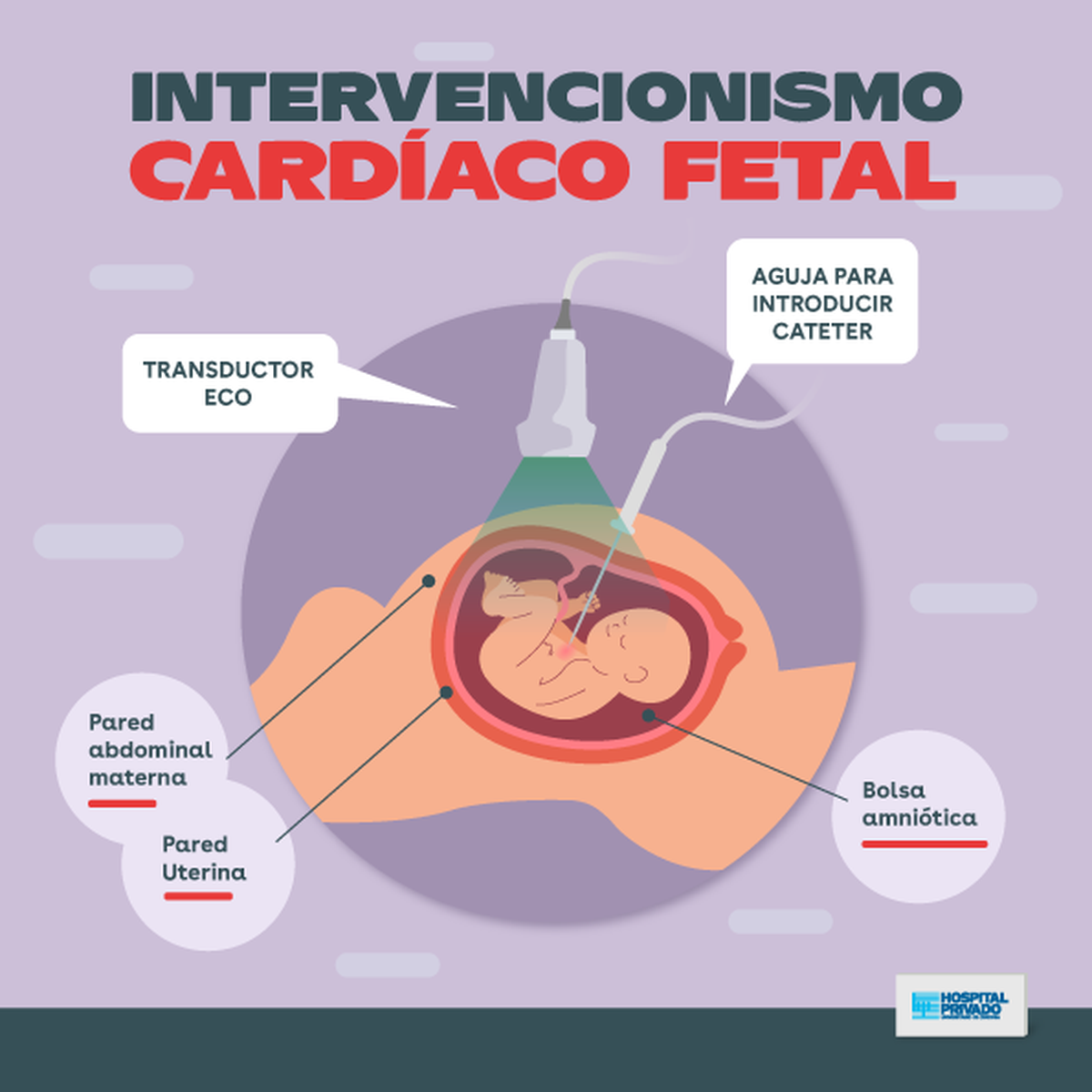 Intervencionismo fetal.