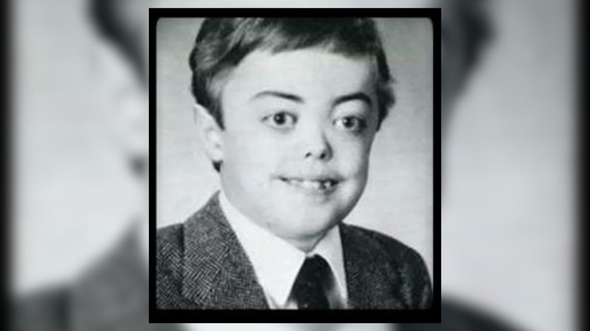 El agresor sexual ten&iacute;a una condici&oacute;n gen&eacute;tica de ni&ntilde;o.