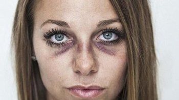 Tras recibir una paliza mostró sus terribles heridas en Facebook para concienciar sobre la violencia doméstica