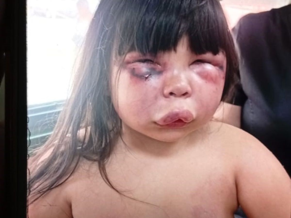 Chacal. Un hombre de 37 años golpeó ferozmente a la hija de 7 años de su pareja. Chacal. Un hombre de 37 años golpeó ferozmente a la hija de 7 años de su pareja. 