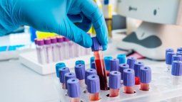 Coronavirus: dos muertos más por coronavirus y ya son 262 en Argentina