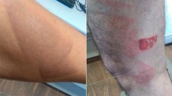 Un matrimonio fue torturado con una plancha y les robaron 22 mil dólares