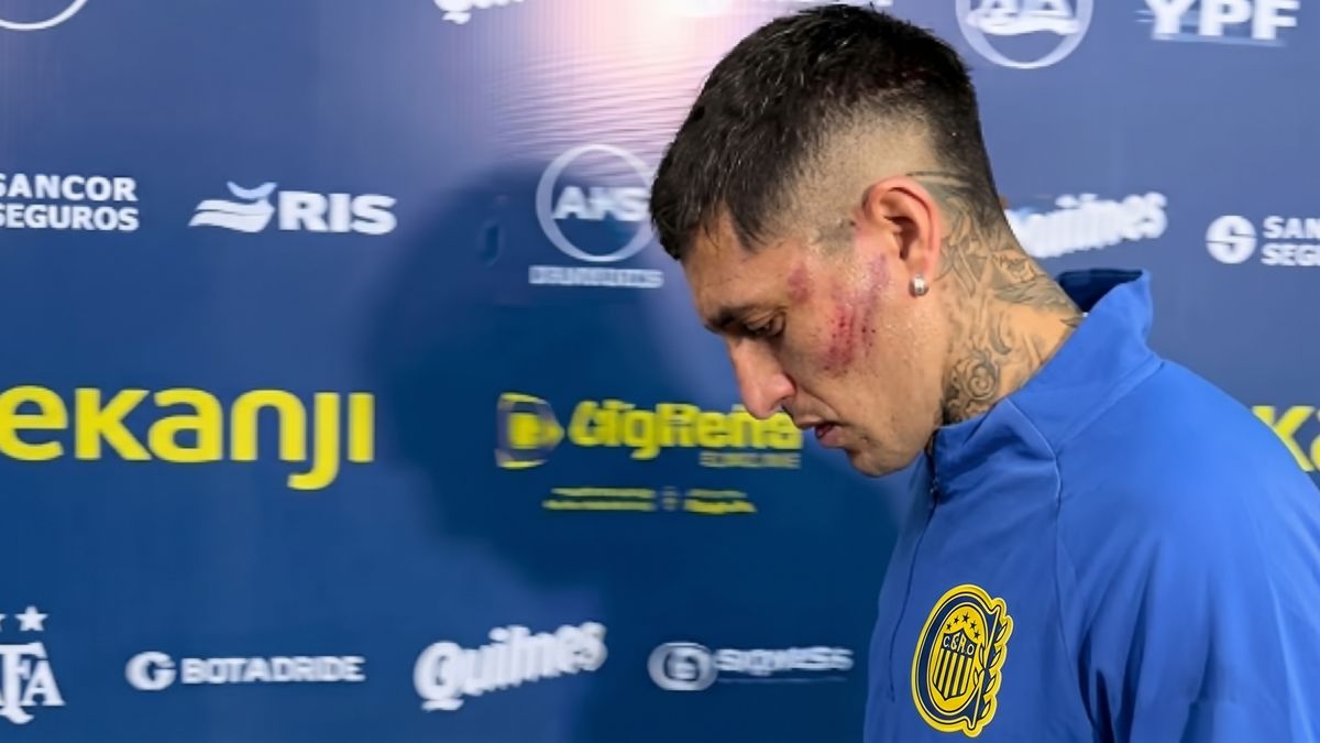 Gastón Ávila terminó en el hospital tras la patada recibida frente a Independiente Rivadavia