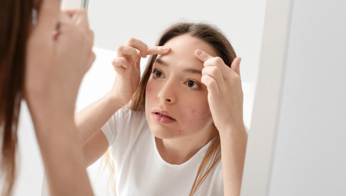 Granitos en la frente. Granitos en la frente.