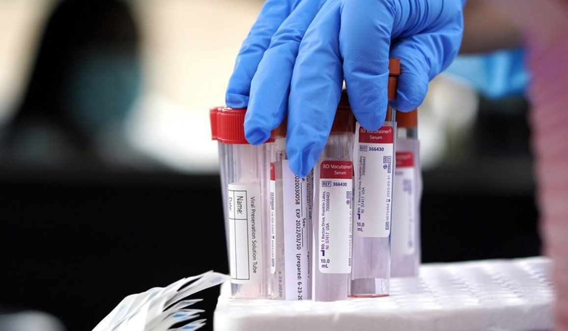 Una mujer de 71 años que padece leucemia linfocítica crónica, se contagió de Covid-19 y permenceció durante 70 días asintomática