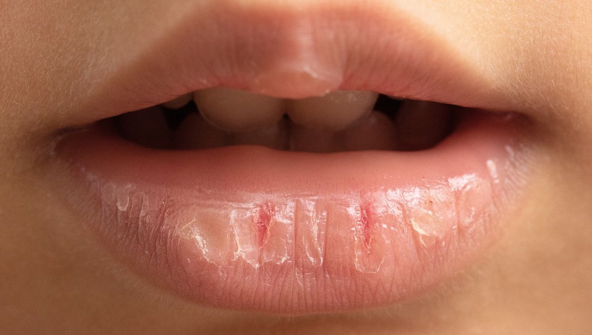 Cómo lidiar con labios secos