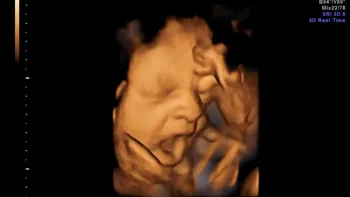 Estudio confirma que las mamás le contagian los bostezos a los fetos en la panza Estudio confirma que las mamás le contagian los bostezos a los fetos en la panza