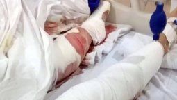 La atacaron tres perros ovejero alemán en una playa de Mar del Plata y se tiró al mar para salvarse