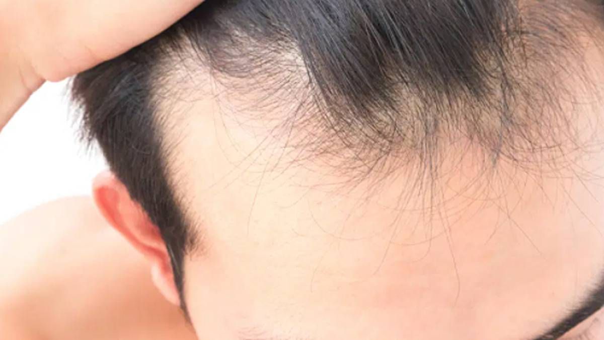 El cabello puede caerse por diversas razones que hay que considerar, sin embargo, este truco casero te ayudará a estimular el crecimiento y evitar su caída. El cabello puede caerse por diversas razones que hay que considerar, sin embargo, este truco casero te ayudará a estimular el crecimiento y evitar su caída.