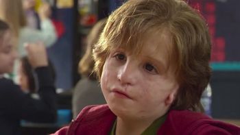 Día Internacional del Síndrome de Treacher Collins: películas que reflejan este trastorno genético