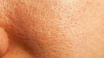 Con qué productos se pueden cerrar los poros para que la piel se vea lisa Con qué productos se pueden cerrar los poros para que la piel se vea lisa