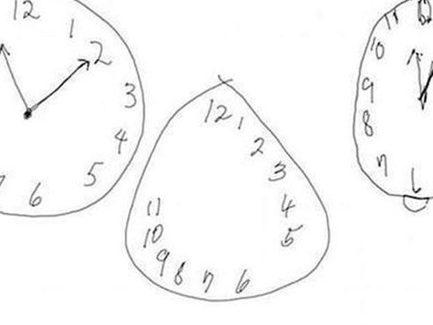 Tu forma de dibujar un reloj permite saber si sufrirás Alzheimer o  Parkinson