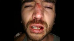 Golpearon y desfiguraron a un joven dentro de un boliche de Luján