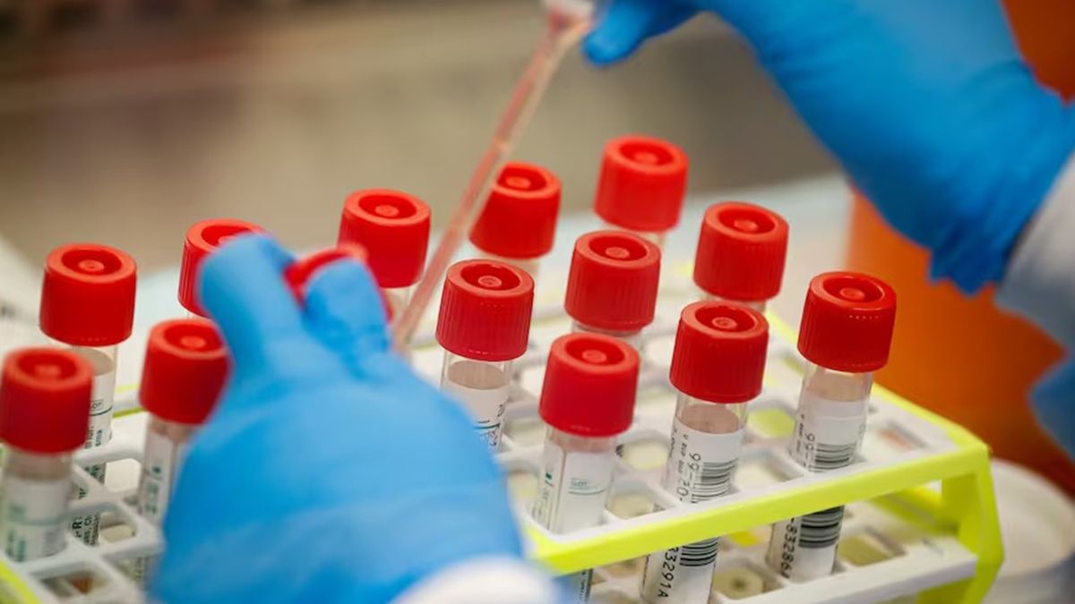 La OMS sigue con atención la nueva variante del coronavirus Covid-19 denominada EG.5. El organismo aconseja no abandonar la vacunación La OMS sigue con atención la nueva variante del coronavirus Covid-19 denominada EG.5. El organismo aconseja no abandonar la vacunación