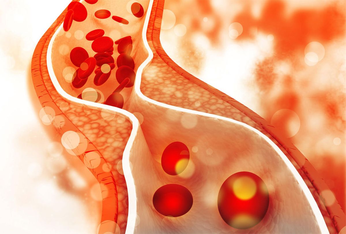 Foto: gentileza MedlinePlus. Foto: gentileza MedlinePlus.