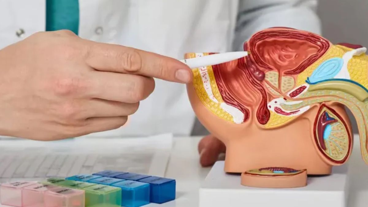 Cáncer de próstata: cuáles son los síntomas para ir urgente al médico