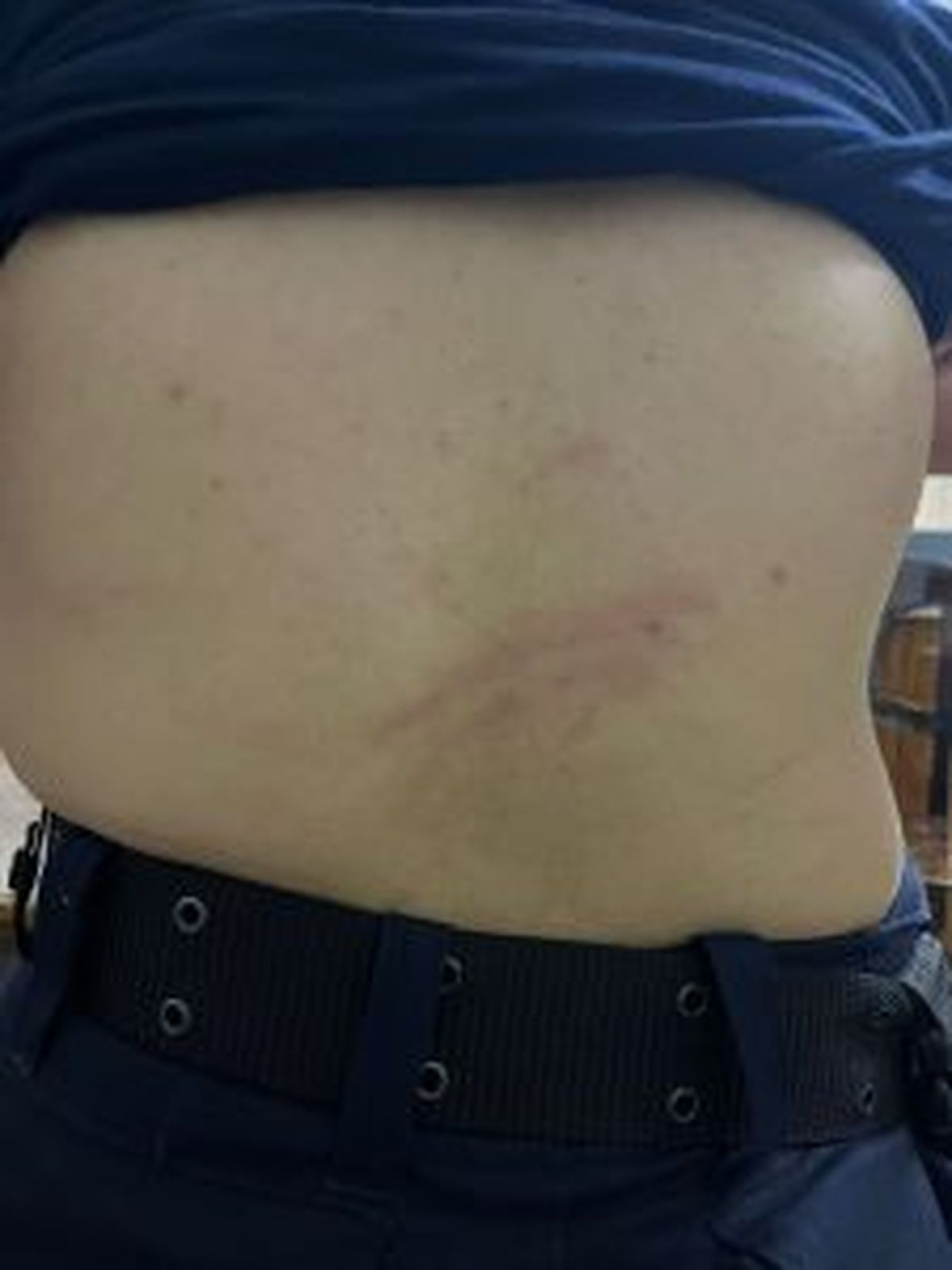 Heridas denunciadas por policías en la manifestación por la universidad pública en San Rafael. Heridas denunciadas por policías en la manifestación por la universidad pública en San Rafael.