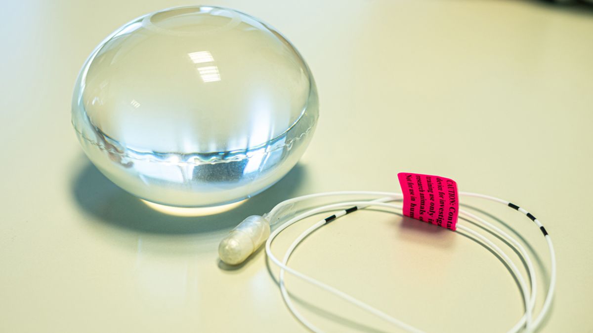 El balón Allurion da sensación de plenitud para reducir el hambre mientras se incorporan nuevos hábitos alimenticios saludables.